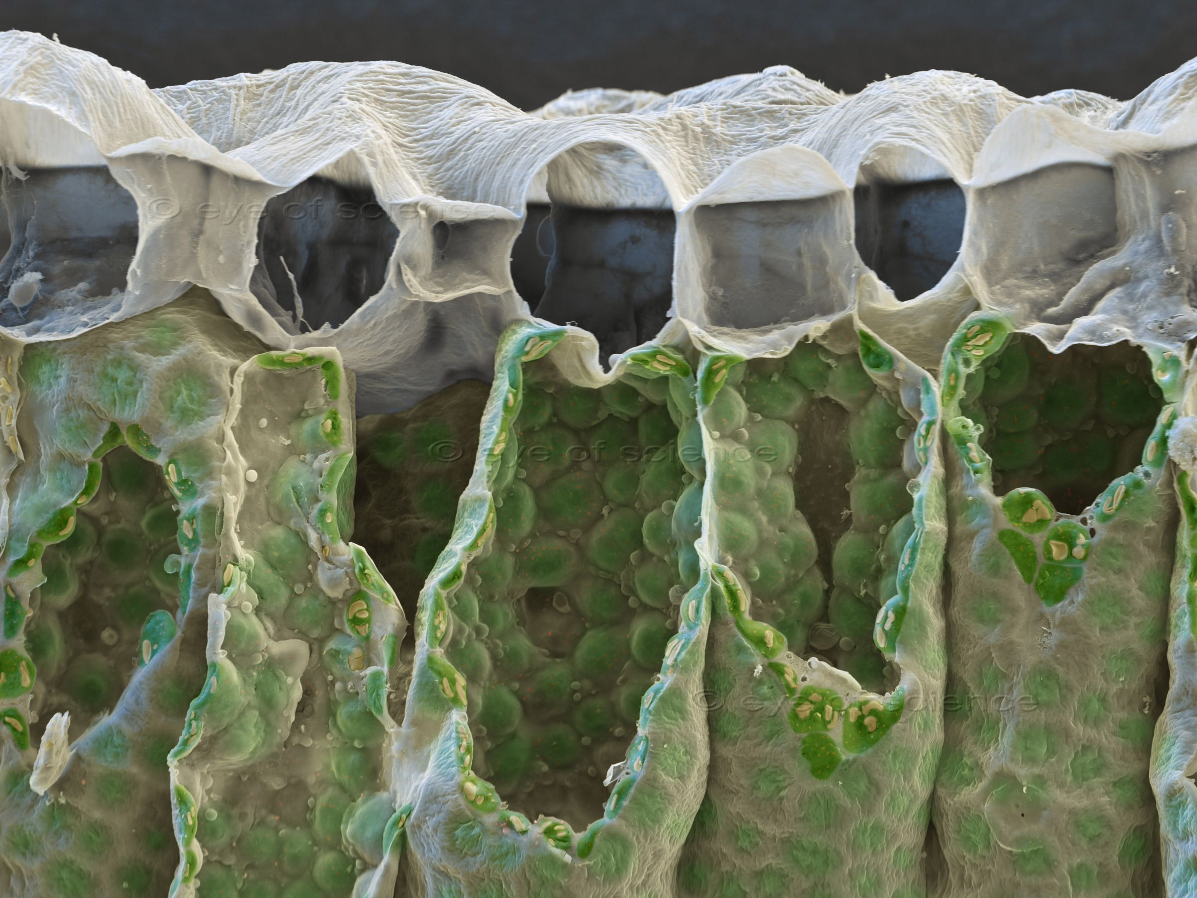 A closer look with the Scanning electron microscope shows the tiny chloroplasts as green bubbles inside the palisades soft tissue.
