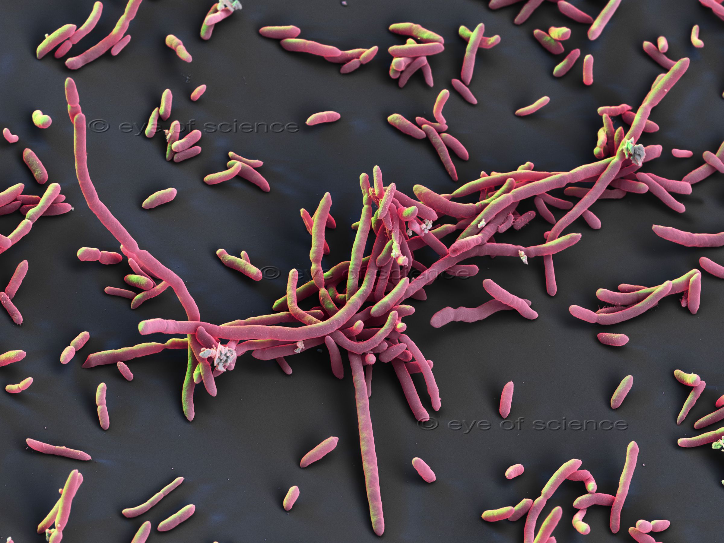 Scanning Electron Microscopic image of red coloured, long bacteria.