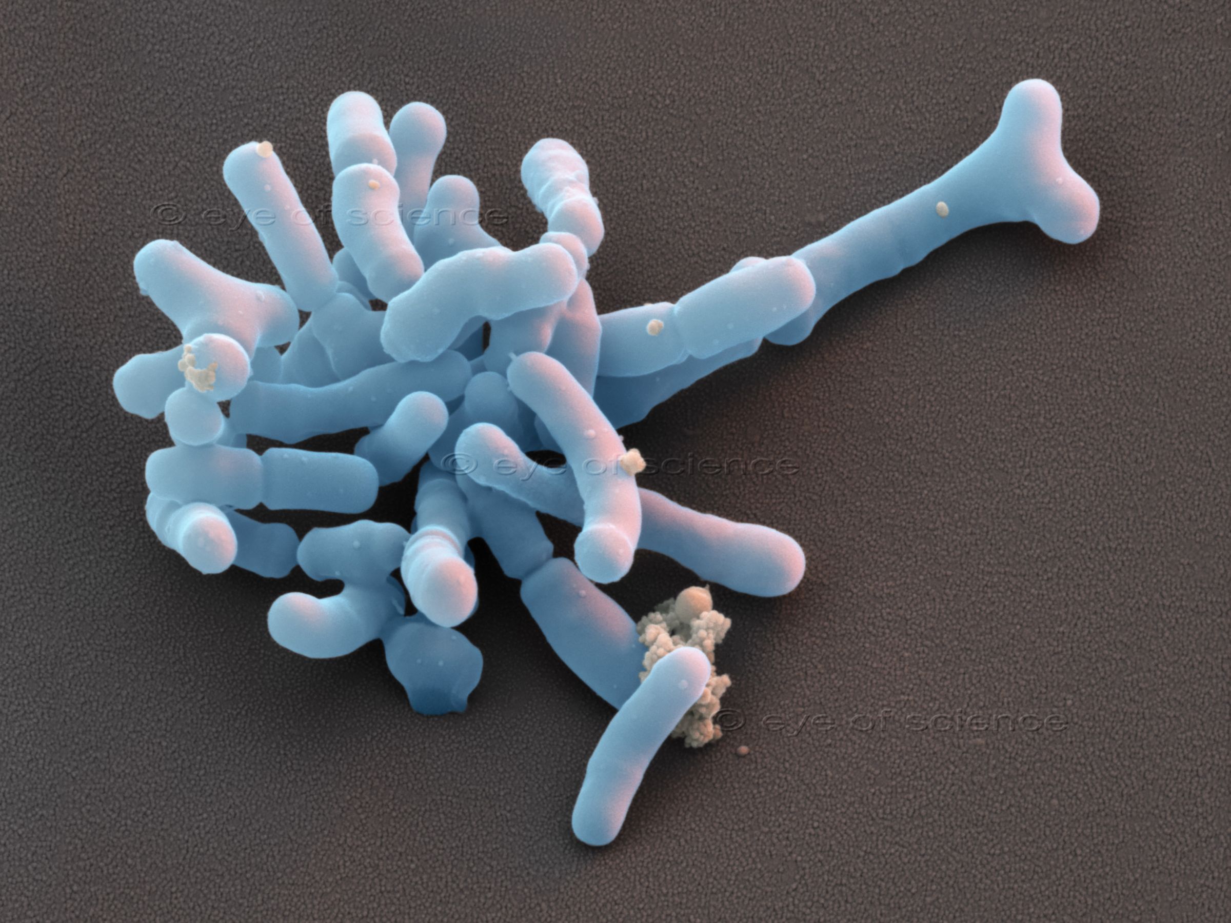 A Scanning Electron Microscopic image showes blueish bacteria with a soft shape on brown ground.